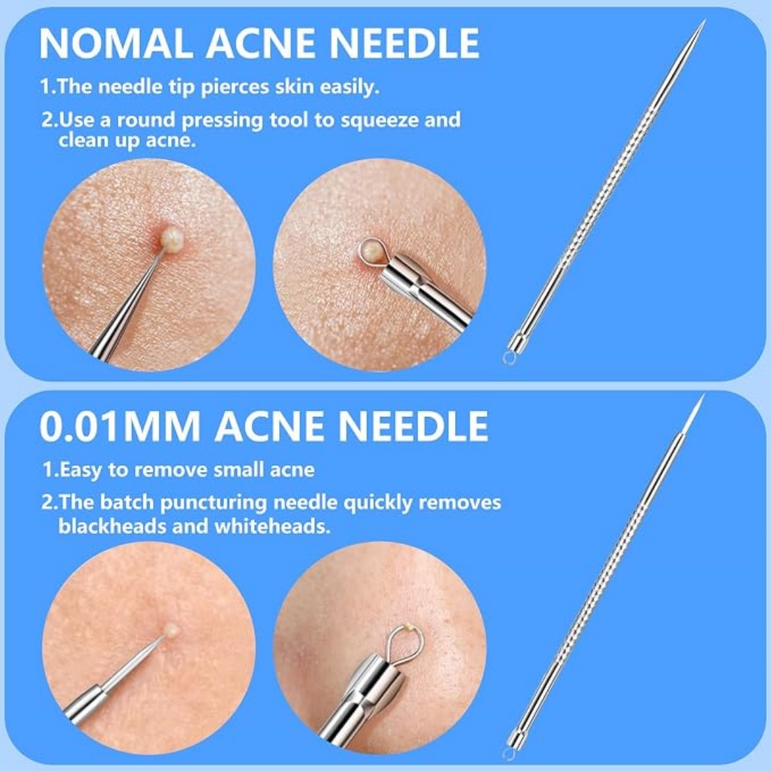5PCS Blackhead Remover Comedon - Luxury Skincare Acne ulasan dan harga