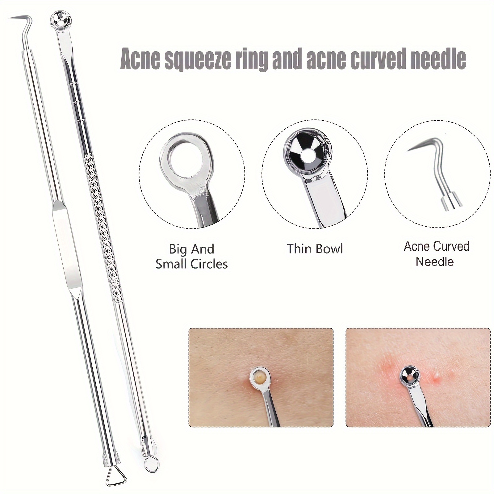 ​6Pcs Stainless Steel Blackhea - Luxury Skincare Acne ulasan dan harga